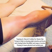 Bamboo Tapping provides relief from chronic muscular pain